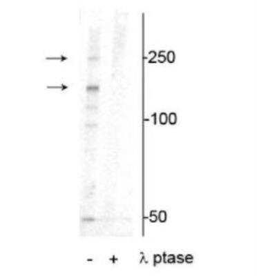 Western Blot: XIRP1 [p Ser295] Antibody [NBP3-11953]